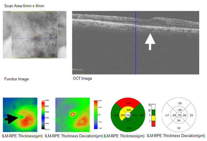 Resolved Fluid (Post)